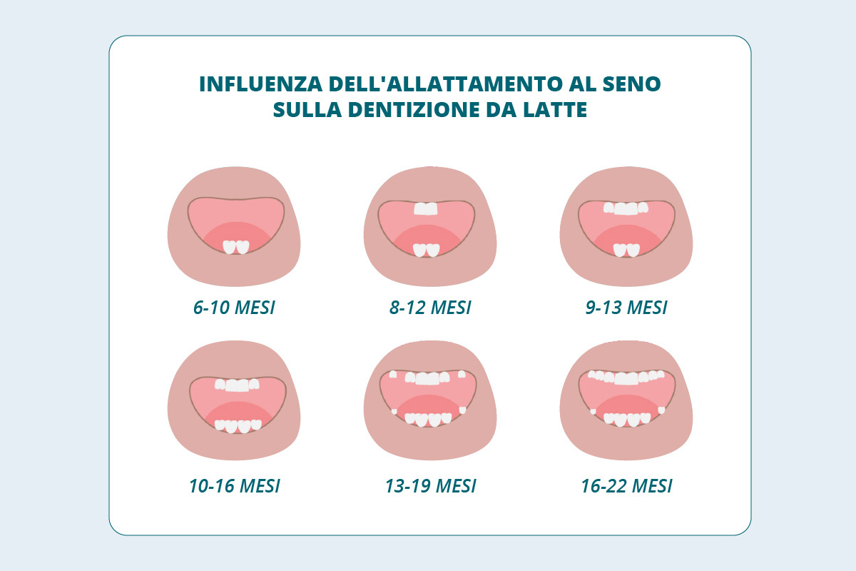 Schema sulla dentizione da latte - come influenza l'allattamento al seno sulla dentizione